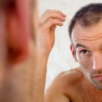 Trapianto di capelli: Fuss, Fue e Hsd a confronto per combattere la calvizie